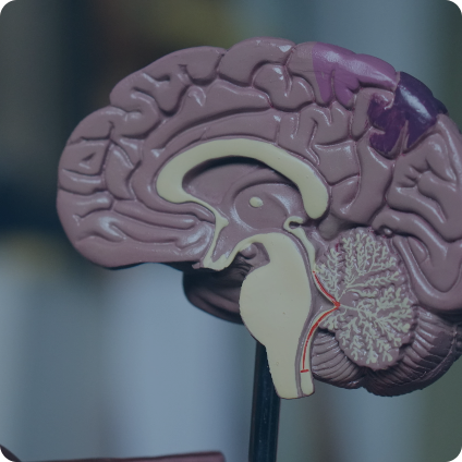 Neuroanesthesia 